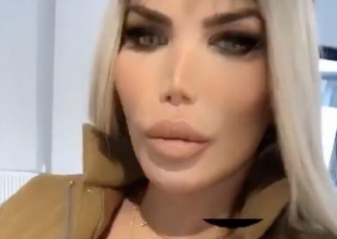 Ex-Ken Humano exibe resultado de silicone nos seios após anunciar transição de gênero