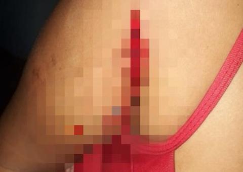 Homem é preso ao tentar matar esposa a golpe de terçado no Amazonas 