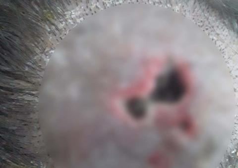 Após infecção, larvas abrem buraco na cabeça de homem: 'comido vivo'