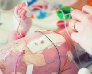 Amazonas gasta R$ 2,4 bilhões e não consegue melhorar a saúde