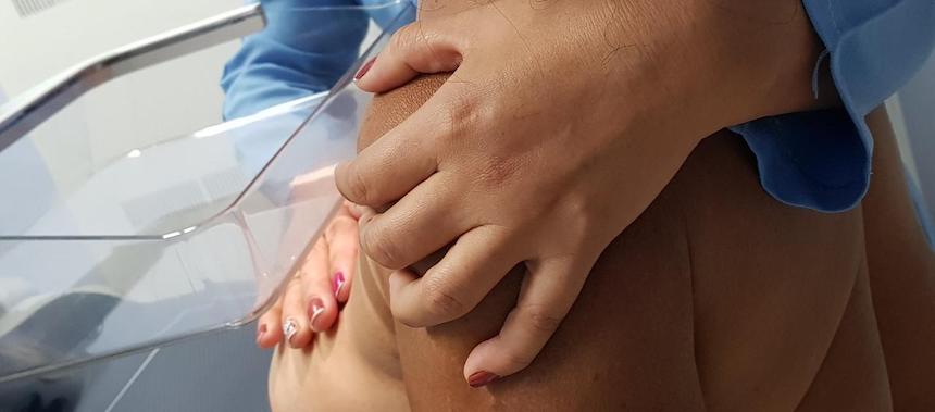 Exame de mamografia via SUS é oferecido sem filas em Manaus