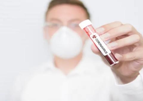 Coronavírus já é a epidemia mais cara dos últimos 20 anos, diz estudo