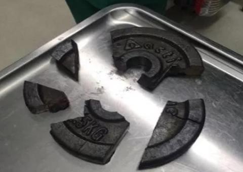 Homem é socorrido após ficar com o pênis preso em anilha de academia