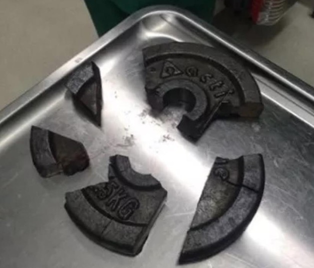 Homem é socorrido após ficar com o pênis preso em anilha de academia