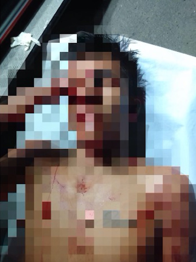 Torturado e prestes a ser morto jovem é salvo por policiais em Manaus