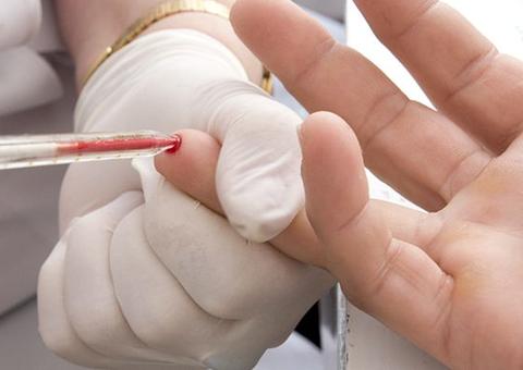 Sem uso de camisinhas, casos de DSTs disparam no Brasil