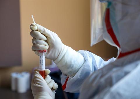 Novo coronavírus: 28 casos suspeitos foram descartados no Brasil