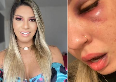 Ex-esposa do goleiro Jean diz que filhas tentaram ajudá-la durante espancamento 