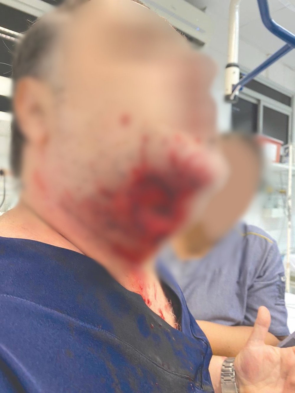 Paciente surta, arranca pedaço de rosto de médico com mordida e quebra portas de hospital
