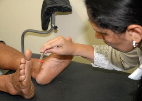 MP lança sistema de atendimento a pacientes com pé-diabético no Amazonas