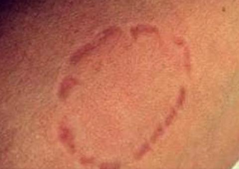 Advogado morde policial em abordagem e diz que não pode ser preso por ser da ‘alta sociedade’