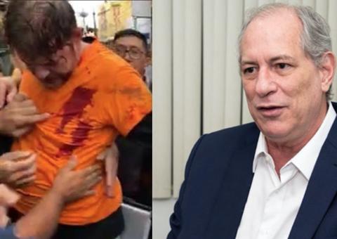 Tiros em Cid Gomes foram próximos ao coração, diz Ciro; saiba estado de saúde