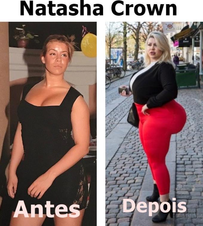 Atriz pornô choca com bumbum de 2 metros; veja antes e depois