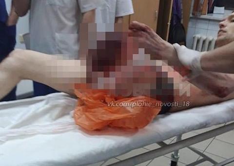 Homem serra a própria perna após usar 'droga zumbi' e misturar com remédios