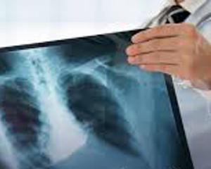 Com fome fica difícil defender a Zona Franca de Manaus