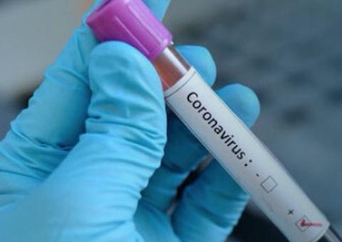 Brasil se torna o primeiro país da América Latina a confirmar caso de Coronavírus 