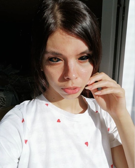 Modelo fica quase cega após pintar olhos de preto, e tatuador pode ir preso