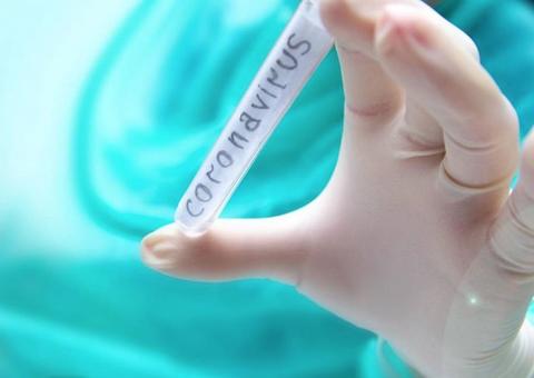 Sobe para 182 o número de casos suspeitos de coronavírus no Brasil