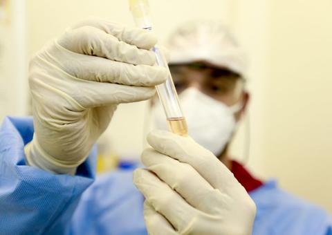 Genoma do vírus que infectou brasileiro é sequenciado em SP