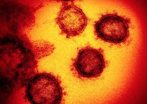 Coronavírus é descartado em paciente de Manaus, diz Governo