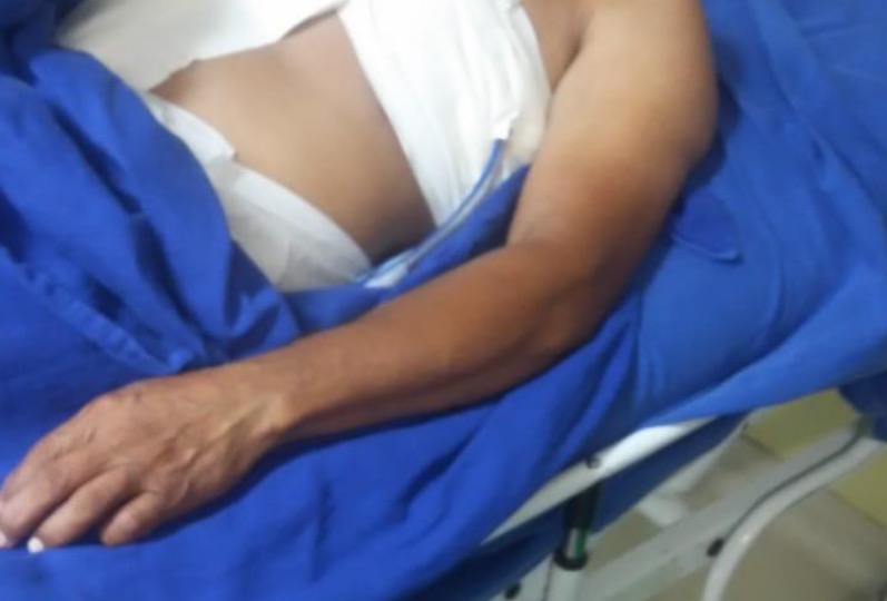 Em Manaus, criminosos invadem Peixaria do Juvenal e atiram em vigilante durante assalto