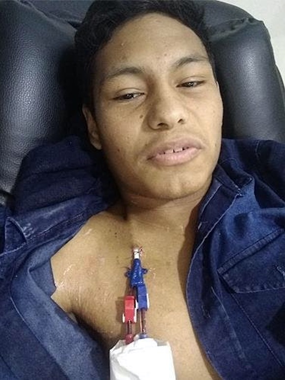 Com doença incurável, família pede doações para ajudar em cirurgia de adolescente em Manaus