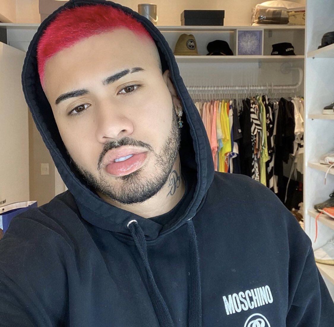 Kevinho se desespera com queda de cabelo após tintura 