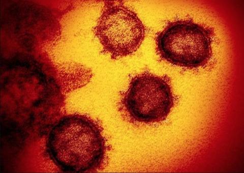 Casos confirmados de Coronavírus no Brasil sobem para 8