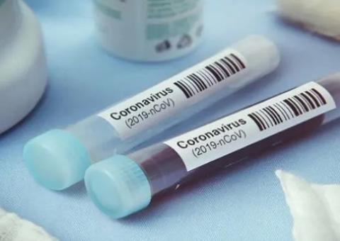 Casos do novo coronavírus sobem para oito; SP tem primeiros registros de transmissão local