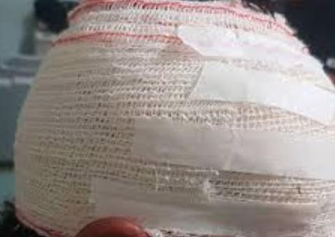 Assaltante vai parar em hospital após levar surra de populares em Manaus