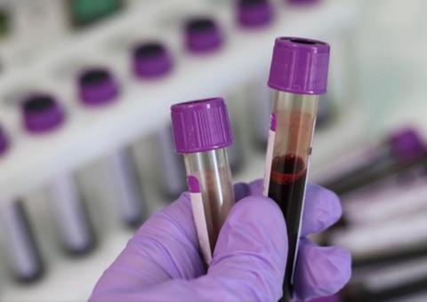 Brasil tem 13 casos confirmados de coronavírus 