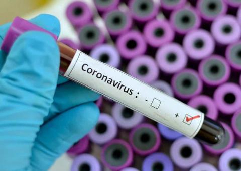 Pesquisadoras analisam epidemia de coronavírus em tempo real