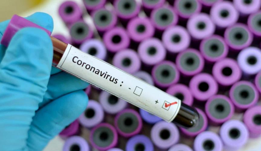 Pesquisadoras analisam epidemia de coronavírus em tempo real