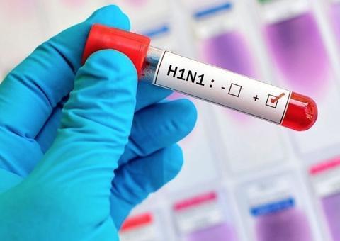 Susam responde MPF e diz que mortes no Amazonas foram por Influenza B e não pela A 