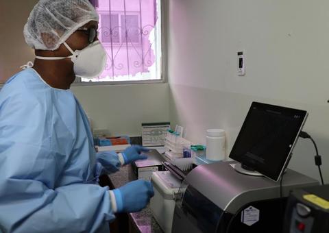 Laboratório no Amazonas começa a realizar testes para diagnóstico do novo coronavírus 