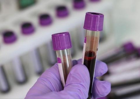 Brasil tem 34 casos confirmados de novo coronavírus, diz ministério