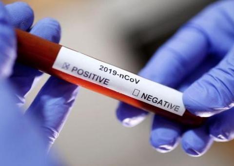 Coronavírus: Sobe para 37 o número de casos confirmados no Brasil