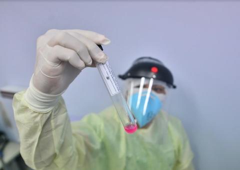 Pernambuco registra dois primeiros casos do novo coronavírus 