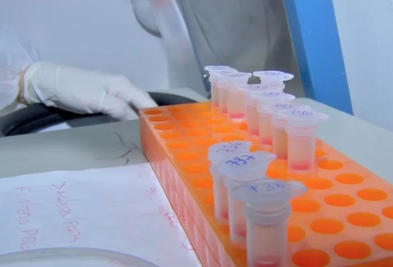 Casos de coronavírus no Brasil saltam para 121 e atingem 13 estados