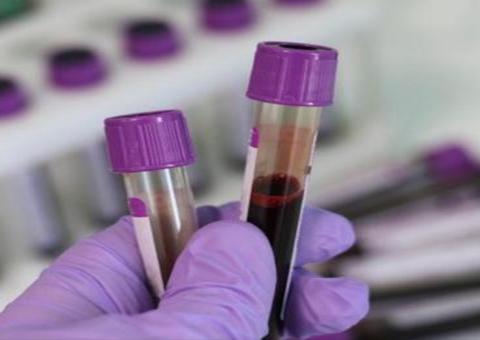 Brasil tem mais de 300 casos de coronavírus em 15 estados