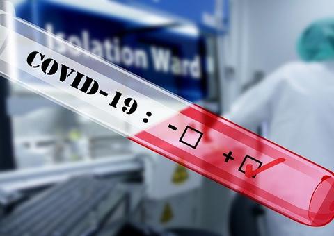 Coronavírus pode mostrar o risco de políticos que desprezam ciência, diz economista