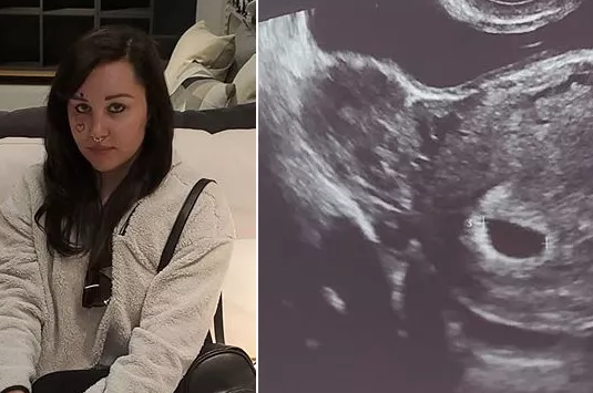 Aos 33, Amanda Bynes anuncia gravidez: ‘bebê a caminho’ 