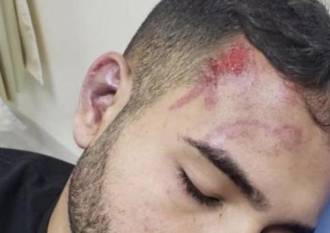 Segundo suspeito de espancar estudante em bloco de Carnaval é preso em Manaus 