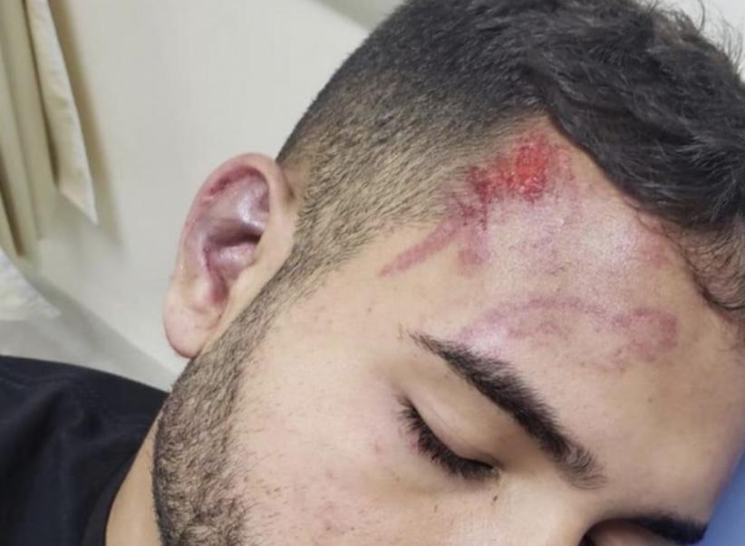 Segundo suspeito de espancar estudante em bloco de Carnaval é preso em Manaus 