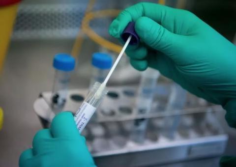 Dez países com maior incidência de coronavírus detêm 89% dos casos