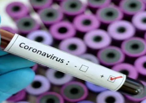 Amapá confirma 1º caso positivo de coronavírus, diz governo