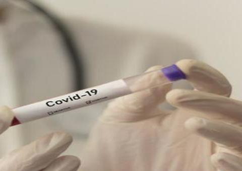 FVS avisa que não vai mais divulgar casos suspeitos de Covid-19 no Amazonas 