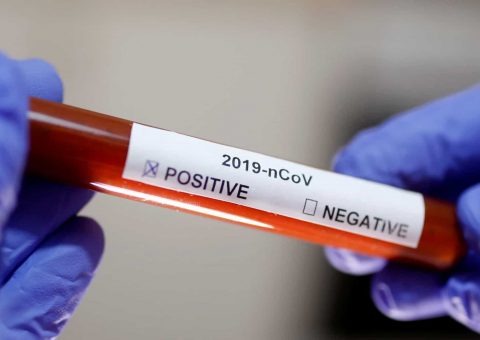 Turista canadense morre em Pernambuco por coronavírus