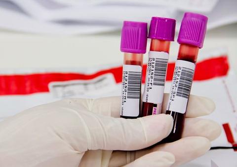 FVS admite demora na coleta de amostras para exames de coronavírus no Amazonas