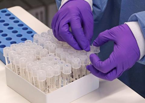 Sobe para 13 o número de mortes por coronavírus no estado do Rio